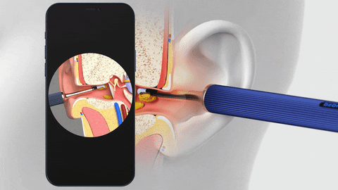 HD Visual Otoscope Ear Pick – Smart Earwax Removal Tool